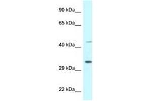 Image no. 1 for anti-Bone Marrow Stromal Cell Antigen 1 (BST1) (AA 108-157) antibody (ABIN6747338) (BST1 抗体  (AA 108-157))