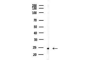 anti-Nuclear Receptor Interacting Protein 2 (NRIP2) (N-Term) antibody