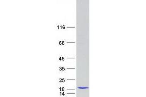 Validation with Western Blot