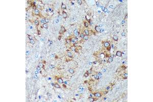 Immunohistochemistry of paraffin-embedded Mouse brain using GRSF1 Rabbit pAb (ABIN7267319) at dilution of 1:100 (40x lens). (GRSF1 抗体)