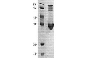 Western Blotting (WB) image for Chloride Intracellular Channel 5 (CLIC5) (Transcript Variant 1) protein (His tag) (ABIN2712879)