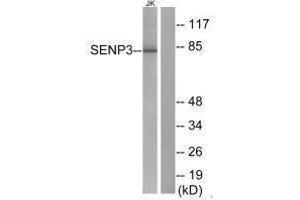 Western blot analysis of extracts from Jurkat cells, using SENP3 antibody. (SENP3 抗体)
