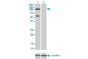 Western blot analysis of TRIM28 over-expressed 293 cell line, cotransfected with TRIM28 Validated Chimera RNAi (Lane 2) or non-transfected control (Lane 1).