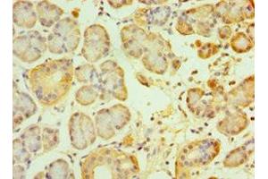 Immunohistochemistry of paraffin-embedded human pancreatic tissue using ABIN7153890 at dilution of 1:100 (GCK 抗体  (AA 1-300))