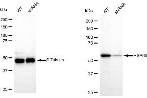 Western blotting analysis using HSP60 antibody (ABIN7798848).