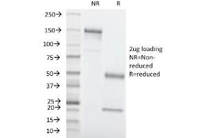 SDS-PAGE Analysis Purified CEA Mouse Monoclonal Antibody (C66/1260). (CEACAM5 抗体)
