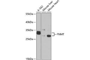 Western blot analysis of extracts of various cell lines, using PNMT antibody (ABIN6130644, ABIN6145848, ABIN6145850 and ABIN6221200) at 1:1000 dilution. (PNMT 抗体  (AA 1-282))