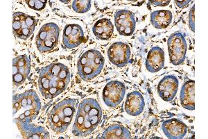 ABIN6258534 and ABIN6274806 at 1/100 staining Rat stomach tissue by IHC-P.
