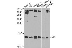 Western blot analysis of extracts of various cell lines, using VIP Antibody (ABIN5970913) at 1/1000 dilution. (Vip 抗体)