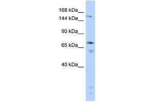 WB Suggested Anti-GRIN2B Antibody Titration:  0. (GRIN2B 抗体  (Middle Region))
