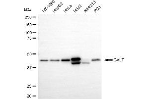 Western blotting analysis using GALT antibody (ABIN7798682). (Recombinant GALT 抗体)