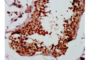 IHC image of ABIN7147315 diluted at 1:500 and staining in paraffin-embedded human testis tissue performed on a Leica BondTM system. (LYAR 抗体  (AA 1-379))