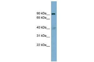 Integrin Beta 5 antibody used at 1 ug/ml to detect target protein. (Integrin beta 5 抗体  (Middle Region))