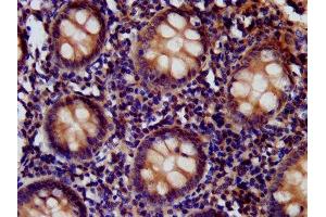 IHC image of ABIN7147205 diluted at 1:400 and staining in paraffin-embedded human appendix tissue performed on a Leica BondTM system. (CD99L2 抗体  (AA 26-145))