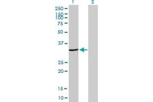 Western Blot analysis of DCK expression in transfected 293T cell line by DCK MaxPab polyclonal antibody. (DCK 抗体  (AA 1-260))
