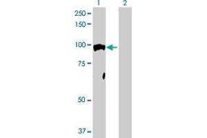 Western Blotting (WB) image for anti-Nuclear Receptor Subfamily 3, Group C, Member 1 (Glucocorticoid Receptor) (NR3C1) (AA 1-777) antibody (ABIN516201)