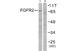 Western blot analysis of extracts from A549 cells, using FGFR2 antibody. (FGFR2 抗体  (Internal Region))