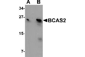 Western Blotting (WB) image for anti-Breast Carcinoma Amplified Sequence 2 (BCAS2) (C-Term) antibody (ABIN1030285) (BCAS2 抗体  (C-Term))