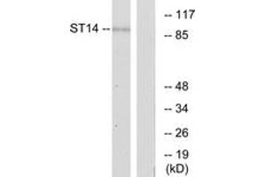 Western blot analysis of extracts from A549 cells, using ST14 Antibody. (ST14 抗体  (AA 10-59))