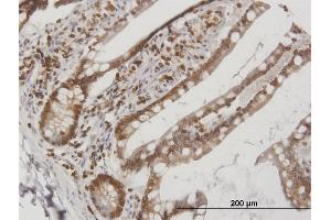 Immunoperoxidase of purified MaxPab antibody to LBR on formalin-fixed paraffin-embedded human small Intestine. (Lamin B Receptor 抗体  (AA 1-615))