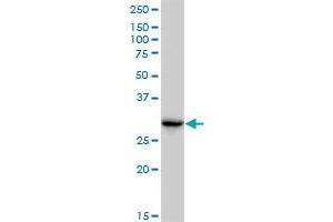 CBR3 monoclonal antibody (M05), clone 1G8. (CBR3 抗体  (AA 180-277))