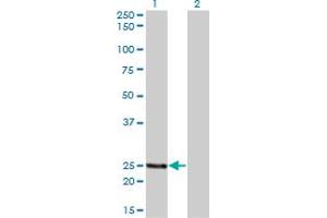 Western Blot analysis of PCTP expression in transfected 293T cell line by PCTP monoclonal antibody (M01A), clone 1F9. (PCTP 抗体  (AA 1-214))