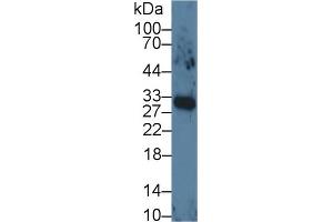 Detection of VEGF165 in Human Lung lysate using Monoclonal Antibody to Vascular Endothelial Growth Factor 165 (VEGF165) (VEGF 165 (AA 28-191) 抗体)