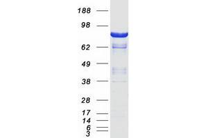 Western Blotting (WB) image for Discs, Large Homolog 4 (Drosophila) (DLG4) (Transcript Variant 1) protein (Myc-DYKDDDDK Tag) (ABIN2719520)