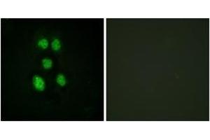 Immunofluorescence analysis of HeLa cells, using VAV1 (Ab-160) Antibody. (VAV1 抗体  (AA 131-180))