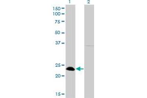 Western Blot analysis of NFYB expression in transfected 293T cell line by NFYB monoclonal antibody (M01), clone 6H6. (NFYB 抗体  (AA 1-207))