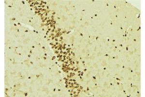 ABIN6276541 at 1/100 staining Mouse brain tissue by IHC-P. (MCM7 抗体  (Internal Region))