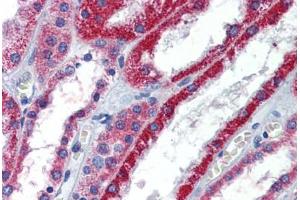 Immunohistochemistry (Formalin-fixed Paraffin-embedded Sections) (IHC (fp)) image for anti-ATPase, Na+/K+ Transporting, beta 1 Polypeptide (ATP1B1) (AA 201-250) antibody (ABIN6747090)