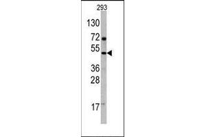 Western Blotting (WB) image for anti-C-Fos Induced Growth Factor (Vascular Endothelial Growth Factor D) (Figf) (C-Term) antibody (ABIN358813)