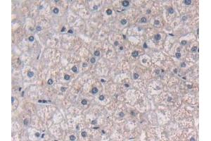 Immunohistochemistry (IHC) image for anti-Sema Domain, Immunoglobulin Domain (Ig), Short Basic Domain, Secreted, (Semaphorin) 3E (SEMA3E) (AA 32-516) antibody (ABIN7430111)