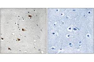 Immunohistochemistry analysis of paraffin-embedded human brain, using E2A (Phospho-Thr355) Antibody. (TCF3 抗体  (pThr355))
