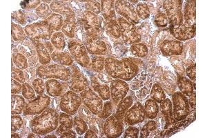 Immunohistochemistry (IHC) image for anti-3'(2'), 5'-Bisphosphate Nucleotidase 1 (BPNT1) antibody (ABIN2856006)