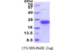 SDS-PAGE (SDS) image for C-Type Lectin Domain Family 1, Member B (CLEC1B) (AA 55-229) protein (His tag) (ABIN5854127)