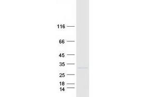 Western Blotting (WB) image for Ribosomal Protein L13 (RPL13) (Transcript Variant 2) protein (Myc-DYKDDDDK Tag) (ABIN2731126)