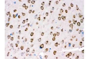 Immunohistochemistry (Paraffin-embedded Sections) (IHC (p)) image for anti-Transient Receptor Potential Cation Channel, Subfamily M, Member 5 (TRPM5) (AA 1021-1108) antibody (ABIN3044566)