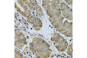 Immunohistochemistry of paraffin-embedded human stomach using CREBBP antibody (ABIN5974440) at dilution of 1/100 (40x lens). (CBP 抗体)