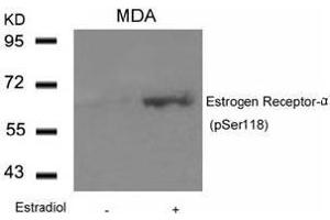 Image no. 3 for anti-Estrogen Receptor 1 (ESR1) (pSer118) antibody (ABIN196743) (Estrogen Receptor alpha 抗体  (pSer118))