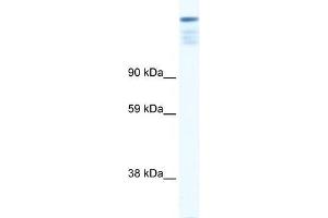 Human Muscle; WB Suggested Anti-ZFP106 Antibody Titration: 0. (ZFP106 抗体  (N-Term))