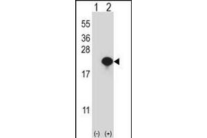 Western blot analysis of CYB5A (arrow) using rabbit polyclonal CYB5A Antibody (Center) (ABIN657954 and ABIN2846899). (CYB5A 抗体  (AA 69-98))