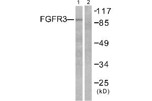 Western blot analysis of extracts from LOVO cells, using FGFR3 antibody. (FGFR3 抗体)