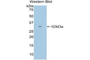 Western blot analysis of the recombinant protein. (CYP26A1 抗体  (AA 250-495))