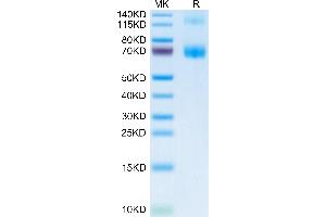 Fc epsilon RI/FCER1A Protein (AA 24-204) (Fc Tag)