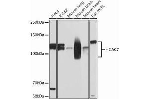 Western Blotting (WB) image for anti-Histone Deacetylase 7 (HDAC7) antibody (ABIN7267712)