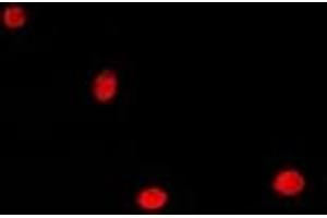 Immunofluorescent analysis of HDGF staining in A549 cells. (HDGF 抗体)