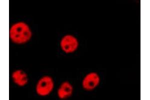 ABIN6266826 staining Hela by IF/ICC. (SKP2 抗体  (C-Term))