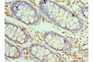 Immunohistochemistry of paraffin-embedded human colon tissue using ABIN7146923 at dilution of 1:100 (CARD8 抗体  (AA 1-200))